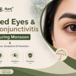 Conjunctivitis During Monsoon – Red Eyes Symptoms and Prevention